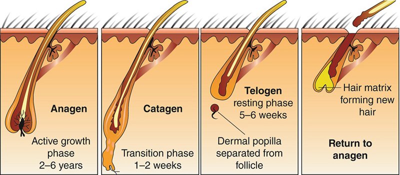 hair loss in adolescence